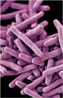 Electron micrograph image of a cluster of rod-shaped drug-resistant Mycobacterium tuberculosis bacteria.
