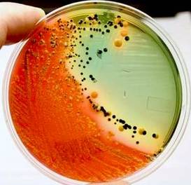 Salmonella can be isolated from many different bacteria by its appearance on specialized media.