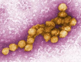 Digitally-colorized transmission electron micrograph (TEM) of the West Nile virus (WNV).